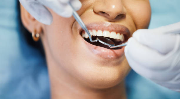 Best Emergency Denture Repair in Morgan Hill, CA