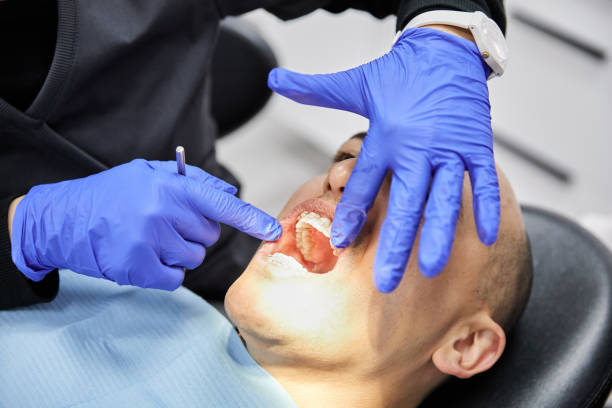 Best Urgent Care for Lost Fillings or Crowns in Morgan Hill, CA
